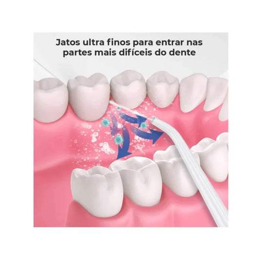 Irrigador Oral Portátil com 1 Bico, 3 Modos de Jato, Recarregável USB – 220ml